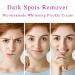 Dark Spot Remover for Face - Nicotinamide Whitening Cream for Melasma & Hyperpigmentation | Visible Results in 28 Days - 0.7 oz - Buy Online on GoSupps.com