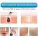 Qukaim Blackhead Suction Instrument Electric Blackhead Removal Suction Face Pore Cleaner Acne Blackhead Remover Household Pore Cleaner - Buy Online on GoSupps.com