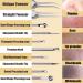 6-Piece Blackhead Remover Tool Kit | Stainless Steel Comedone Extractor Set for Acne, Blemish, Whitehead Removal | Tweezers, Needles, Patches for Nose & Face Skin - Buy Online on GoSupps.com
