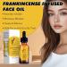 2PC Frankincense Facial Essential Oil - Moisturizes and Nourishes the Face Body Suitable for All Skin Types Suitable for Massage Shower and Relaxation - Buy Online on GoSupps.com