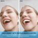 Buy XZLZMD Pebble Gel Dental Prostheses - Natural Color Temporary Veneers for Cracked or Missing Teeth - Fast International Shipping - Buy Online on GoSupps.com