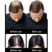 1BAG Hair Building Fibers Instant Hair Loss Treatment Color Powder Conceal Thinning Hair Add Volume For Both Men & Women(Black)  - Buy Online on GoSupps.com
