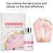 SEMME Corn Remover Pad 10ml - Foot Corn Callus Removal Cream for Pain Relief - Buy Online on GoSupps.com
