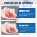 ACWOO Anti Snoring Devices Stop Snoring Devices Effective Snoring Solution Snore Stopper Reusable Stop Snoring Aids Snoring Sleeping Aid Device for Men and Women Restful Night's Sleep - Buy Online on GoSupps.com