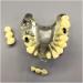 Fhuili teeth implant model-implant recovery model with removable chewing gum and prosthesis-section Half-Port Bridbild-Restauration model for study lessons a