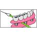 I Dontix Brace X-Floss Green - Easy-to-Use Dental Floss for Efficient Cleaning - Buy Online on GoSupps.com