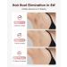 LYSMOSKI IPL Laser Hair Removal Device - Painless & Safe At-Home Hair Remover with Ice-Cooling System for Armpits Legs Face & Bikini Line - Rose Gold - Buy Online on GoSupps.com