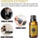 Abdominal Drainage Ginger Oil | Lymphatic Detox Massage Oil | Anti-Aging Essential Oil for Skin Lightening - Buy Online on GoSupps.com