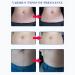 30 ml Essential Strain Strips Oil - Nourishing Moisturizer for Face & Body Dry Skin Relief Moisturizing Serum - Buy Online on GoSupps.com