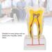 Professional Dental Nerve Model for Teaching | Resin Tooth Model for Students | International Shipping - Buy Online on GoSupps.com
