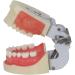 Life-Size Human Teeth & Abscess Model - Perfect for Student Teaching & Practice - Buy Online on GoSupps.com