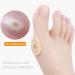 Corn Cushions MQ 60 Pcs Corn Plasters Corn Pads Soft Latex Foam Self Adhesive Callus Pads Corn Pad Anti Friction Reduce Foot and Heel Pain for Toe Callus Anti-Slip 60 Count - Buy Online on GoSupps.com