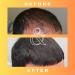 Mane Regain RU58841 5% Solution - DHT Blocker for Hair Loss - Promotes Regrowth & Prevents Baldness - 30ml - Buy Online on GoSupps.com