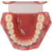 Orthodontic Model | 28 Partial Dental Resin Demonstration & Bracket Model for International Shipping - Buy Online on GoSupps.com