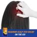 Scalpicin Max Strength Scalp Itch Treatment - 1.5 oz (Pack of 2) | Fast Shipping Worldwide - Buy Online on GoSupps.com