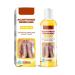 Extra Strong Peeling Oil Chemical Exfoliant For Face Body Exfoliant Yellow Peeling Oil Peeling Oil Reduces Wrinkles and Stretch Marks Removes Dead Skin Marks