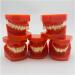 Teeth Educational Model - Orthodontic Classification & Lesson Model for Dental Training | International Shipping Available - Buy Online on GoSupps.com