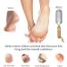 Foot Rasp Callus Remover - Professional Stainless Steel Pedicure Scrubber for Cracked Feet & Dead Skin | Heel & Corns Care Tool - Buy Online on GoSupps.com