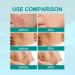 Medical Grade Scar Spray Effective Scar Removal for Surgical Scars & Stretch Marks | All Skin Types - Buy Online on GoSupps.com