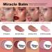 Miracle Balm Natural Healing Balm for Dry Skin Cracked Lips and Sensitive Areas Nourishing Moisturizer Ingredients for Soothing Relief and Hydration for All Skin Types (Natural Large) Natural Large - Buy Online on GoSupps.com