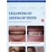 SP-7 Whitening Toothpaste (Red) - Clean Mouth & Anti-Caries | Buy Internationally - Buy Online on GoSupps.com