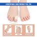 Bunion Corrector Kit for Men & Women | Pain Relief for Hallux Valgus | Big Toe Separators & Exercise Strap - Buy Online on GoSupps.com