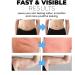 Kaotic Von Magic Tape for Stomach Weight Loss 5M/Roll Kaotic Von Magic Tape for Stomach Weight Loss Kaotic Von Magic Tape Fat Reduction Tape Magic Tape Waist Cincher Belly Nude - Buy Online on GoSupps.com