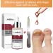 Maximum Strength Nail Fungus Repair Treatment - Natural Formula for Toenail and Fingernail Repair - Buy Online on GoSupps.com