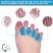 Toe Separator Set of 4 - Bunion Corrector for Men & Women | Blue & Pink Toe Spacers for Pain Relief - Buy Online on GoSupps.com