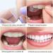 Advanced Teeth Whitening Strips Kit - 14 Double Elastic Gel Strips for 7 Treatments - Buy Online on GoSupps.com