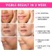 ANAiRUi Glycolic Acid Facial Pads with Vitamins B5 C & E - Exfoliating Pads for Dark Spots, Acne, Fine Lines & Wrinkles (80 Pads) - Buy Online on GoSupps.com