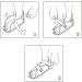 ZJchao Post Op Shoe for Broken Toe | Open Toe Fracture Boot | Orthopedic Foot Support & Protective Cast for Injury (L) - International Shipping Available - Buy Online on GoSupps.com