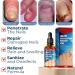 2PCS German Toenailplus Anti Paronychia Relief Oil - Nail Repair for Damaged Thick Nails - Buy Online on GoSupps.com