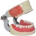 Life-Size Human Teeth & Abscess Model - Perfect for Student Teaching & Practice - Buy Online on GoSupps.com