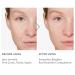 Vitamin C Serum for Face - Anti-Aging with Hyaluronic Acid Vitamin E & Retinol | Dark Spot Remover & Wrinkle Reducer for Women - Buy Online on GoSupps.com