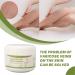 Natural Varicose Veins Cream - Strong Penetration & Safe Ingredients | Effective Relief Worldwide - Buy Online on GoSupps.com