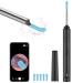LESIBO Ear Wax Removal Kit with Camera Ear Cleaning Kit for iPhone Ear Cleaner Earwax Removal Kit Ear Scope Otoscope with Light Earwax Removal Tools for Adults and Baby Earwax Remover Ear Pick System Less Picks