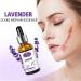 AICHUN BEAUTY Lavender Extract Scar Repair Essence | Anti-Scar Essential Oil for Smooth Skin | 30ml - Buy Online on GoSupps.com