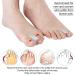 Soft Toe Separator & Gel Toe Caps - 8 Pack Hallux Valgus Spreader for Optimal Toe Protection & Correction - Buy Online on GoSupps.com