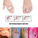 HouChanges Toe Straighteners - Reusable Splints for Bent, Hammer, Overlapping, and Broken Toes (3Pcs) - Buy Online on GoSupps.com