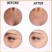 Anti-Wrinkle Reusable Silicone Patches Wrinkles Patches Chest Wrinkle Pads Facial Wrinkle Remover Strips Wrinkle Patches for Face Neck and Chest (11 Pcs) - Buy Online on GoSupps.com