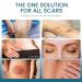 Advanced Scar Cream Gel - Effective Scar Removal for Surgical Scars Burns Acne C-Sections & More | Suitable for All Skin Types - 1.06 Oz - Buy Online on GoSupps.com