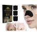 Nose Strips for Blackheads - 15 Pack Pore Strips for Men & Women - Effective Blackhead Removal - Buy Online on GoSupps.com