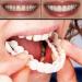Customizable Temporary Fake Teeth 2 PCS - Smile Improvement and Whitening Substitute for Everyone - Multicolor - Buy Online on GoSupps.com