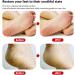 Premium Glass Foot File | Callus Remover with Etching Technology | Portable Foot Scraper for Cracked Heels | Shining Blue - Ideal for Wet & Dry Feet - Buy Online on GoSupps.com