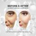 Skin Tightening Face Lifting Mask with Hyalpol Matrix Age-Defying Formula | Tube-Type Long-Lasting & Cruelty-free | Travel Friendly - Buy Online on GoSupps.com