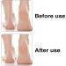 Premium Bimsstein Bar & Pumice Stone Foot Scrubber - High-Quality Foot Care for Cracked Heels & Dead Skin Removal | International Shipping - Buy Online on GoSupps.com