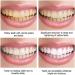 Yanjiayi Bamboo Charcoal Toothpaste for Whiter Teeth Activated Charcoal Deep Clean Toothpaste (1 Piece) - Buy Online on GoSupps.com