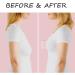 Clear Breast Lift Tape for A-DD Cup Large Breast | Invisible Push Up Tape | Sweatproof Body Tape for Breast Lift - Christmas Elk Nipple Covers Included - Buy Online on GoSupps.com