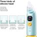 JHONE Eustachian Tube Unclogger | Ear Pressure Relief for Flying Diving & Tinnitus - Balance Ear Pressure Anytime - Buy Online on GoSupps.com